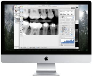 Digital Radiographs (X-rays)