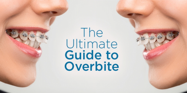 The difference between overjet and overbite