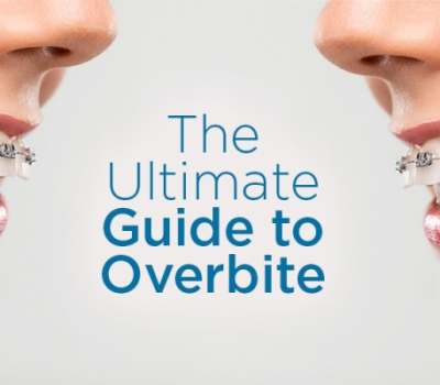 The difference between overjet and overbite