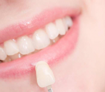 Smile dentist – that’s us!